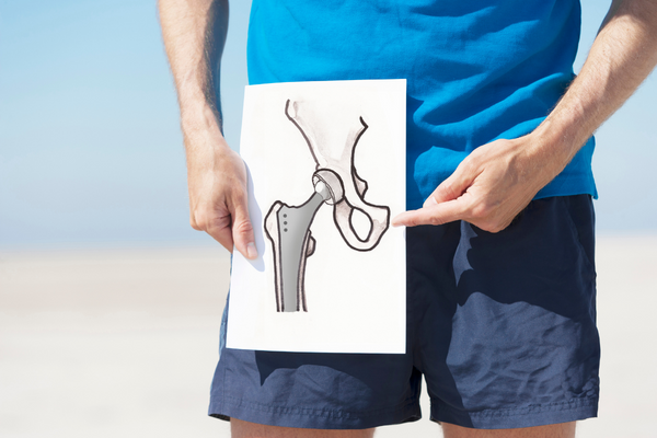 Hip Replacement Surgery In Gurgaon