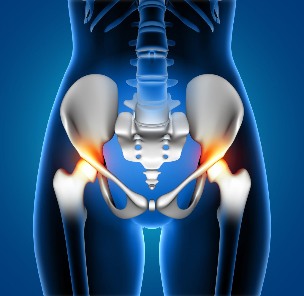 Best Hip replacement Gurugram