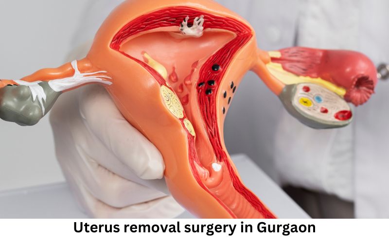 Uterus removal surgery in Gurgaon