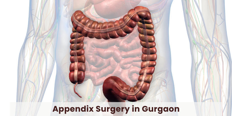 Appendix Surgery in Gurgaon