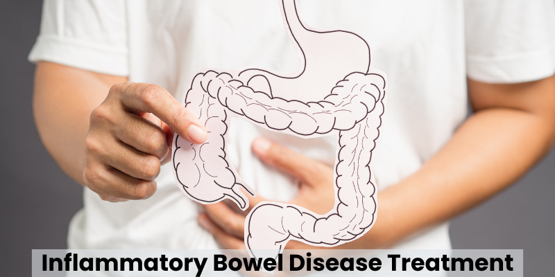 Inflammatory Bowel Disease Treatment