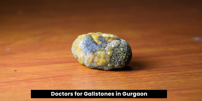 Best Doctors for Gallstones in Gurgaon
