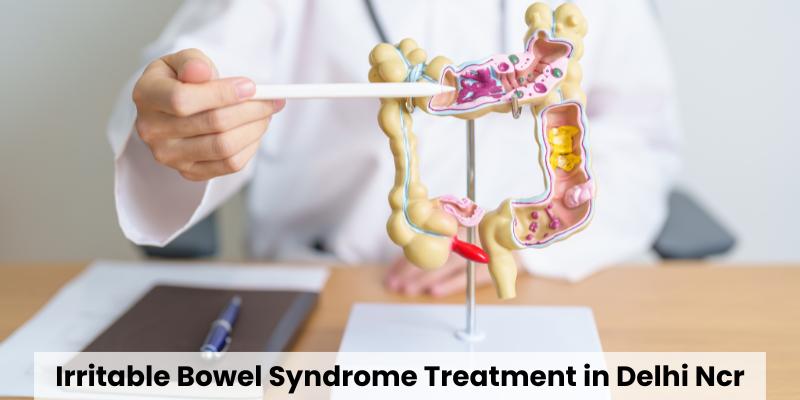 Irritable Bowel Syndrome Treatment in Delhi Ncr