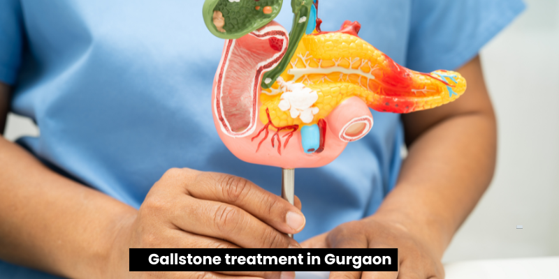 gallstones treatment in Gurgaon: