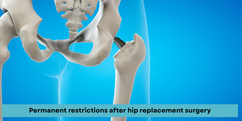 Orthopedic surgeon explaining hip replacement restrictions in Gurgaon