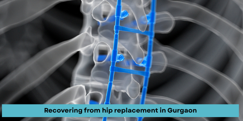 Patient recovering from hip replacement surgery in Gurgaon hospital