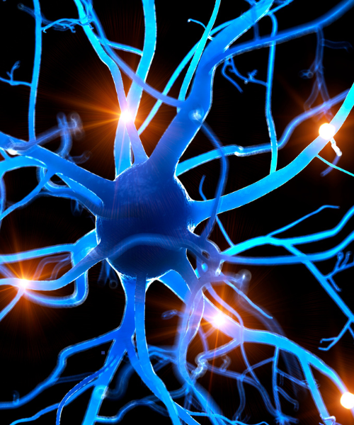 Brain aneurysm treatment using neurointervention at Kalyani Hospital Gurgaon with 20+ years of expertise.