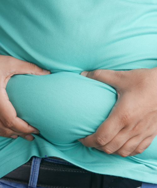 Bariatric surgery in Gurgaon for long-term weight loss