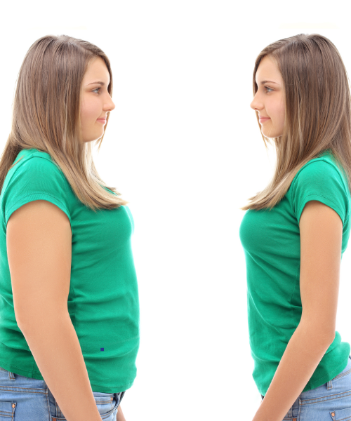 Weight loss surgery specialists at Kalyani Hospital Gurgaon