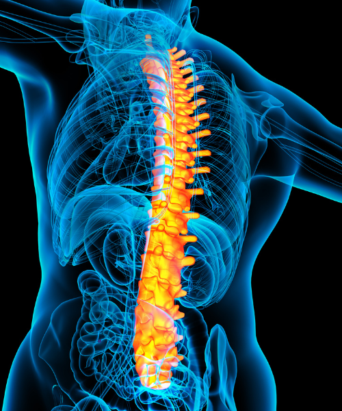 Lumbar microdiscectomy for slipped disc at Kalyani Hospital Gurgaon