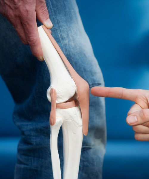Knee joint implant during knee replacement surgery in Gurgaon