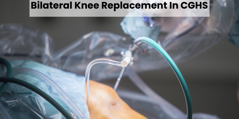 Bilateral Knee Replacement in CGHS