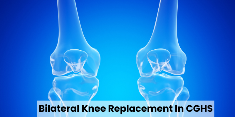Bilateral Knee Replacement in CGHS