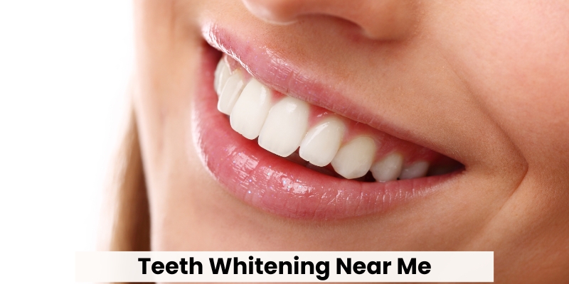 Teeth Whitening Near Me