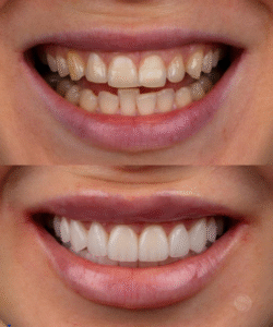 Personalized treatment planning for patients