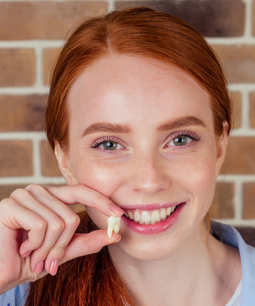 Wisdom Tooth Removal