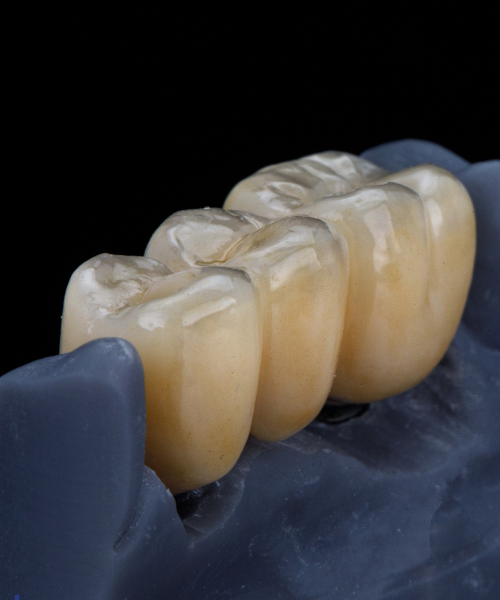 Dentures and Bridges