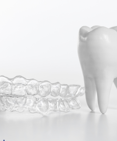 Invisalign Treatment