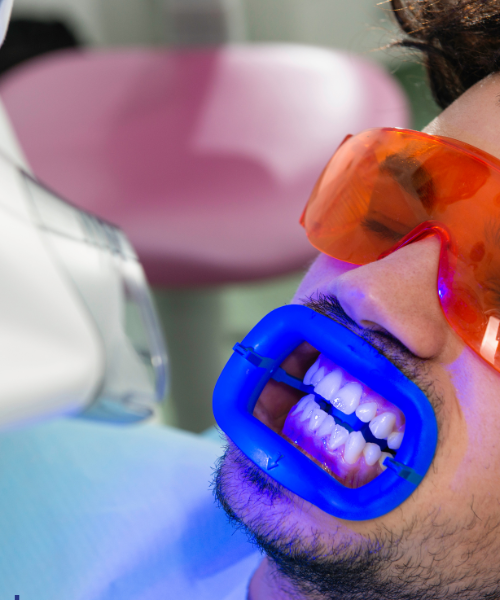 Laser Gum Treatment in Gurgaon