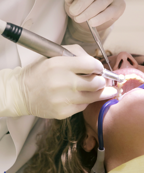 Pulpotomy in Gurgaon