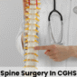 knee replacement in CGHS 85x85